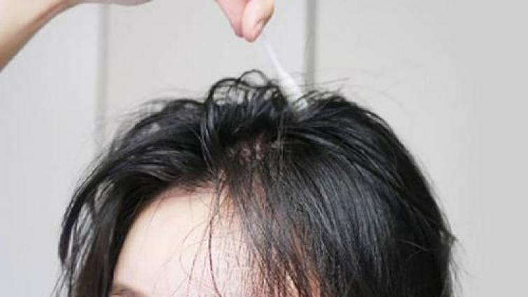 【最智慧商学院】“秃”如其来的大市场！3年急增106亿元！